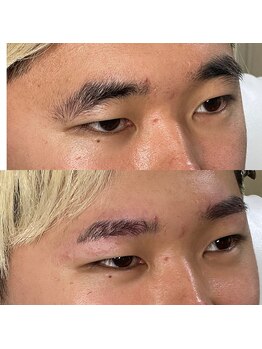 ビオプラス(BIO PLUS)/