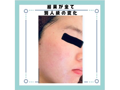 スノースキン(Snow skin)の写真