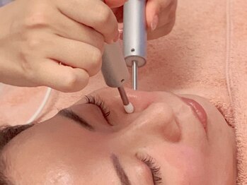 ヴィエンナ VIENNA/【脂肪撃退】頬肉ペッタンコに!