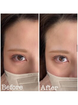 エイジレス(AGELESS)/Before After