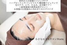 ウォーム(Warm)