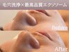 【毛穴ケア/たるみ改善/リフトアップ】毛穴洗浄＆吸引＋エクソソーム（90分）