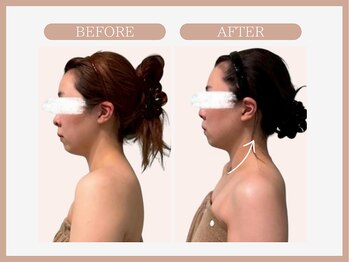 アコガレコガオ 仙台店/