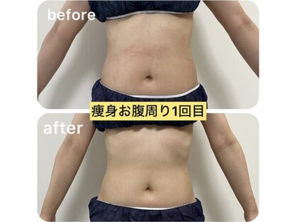 アーチ(AR-CH.)の写真