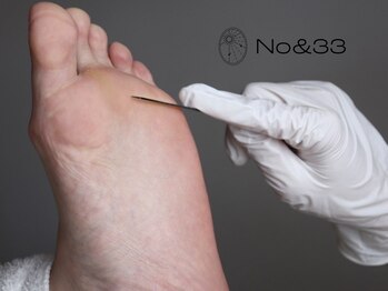 ナンバーアンドスリーサン(No&33)の写真/ハンドとフットの角質ケアはもちろん、爪のお悩みもお任せ下さい!韓国式フットケアで清潔感のある美足に♪