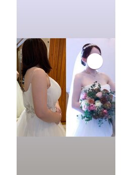 アユアランリンク 札幌店/30代/約7ヵ月/ブライダル