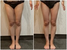 美容整体 ウェリナ 蟹江院/小顔矯正/骨盤矯正/美脚サロン