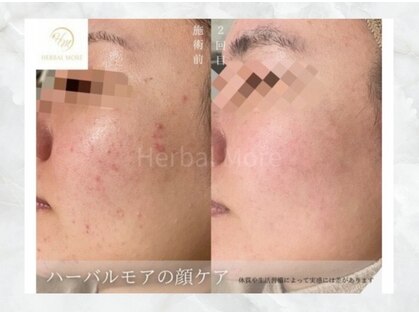 澄葉 新宿(sumiha)の写真