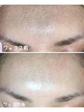 リュクスルーム(Luxe room)/潤艶WAX脱毛１回　額