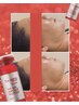 【大人女性の輪郭美へ】最新プラズマ×レッドショット★贅沢たるみケア