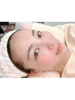 小顔になりたい