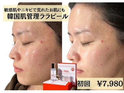 あすはれの写真