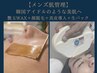 【メンズ肌管理】艶玉WAX+顔脱毛+真皮導入+生パック ¥27500 → ¥16500