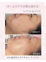 ティアラ(Tiara)/