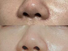シャルトルズの雰囲気(11年の毛穴専門店実績から生まれた「リバース毛穴洗浄」がうり)