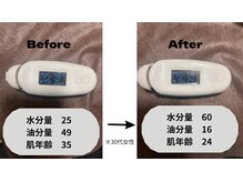 Quale/毛穴洗浄後のBefore→After