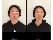 サロン シエラ/施術1回 &nbsp;50代