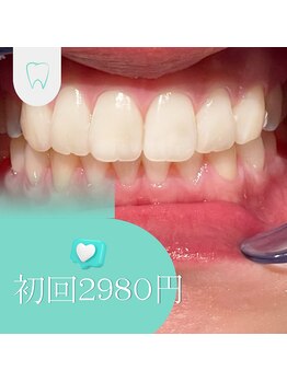 プラスビーセルフ(+b self)/初回ホワイトニング2980円