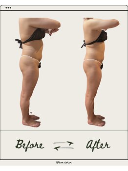 ドゥ ドルチェ(Due dolce)/全身のお掃除を！　1度の施術