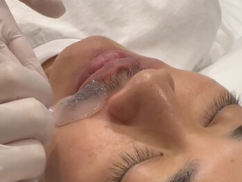 ブランスキンラボ(BLANC.skin LAB)の写真/【メンズひげ脱毛・初回¥3300円】最新機器で脱毛しながら、お肌もメンテ◎