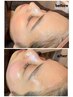 【産毛角質ゴッソリ除去】うる艶お肌☆美肌フェイスWAX脱毛 1回 7,200円