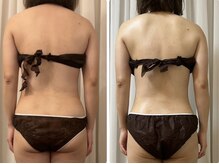 フォルスボーテ(Force Beaute)/脂肪分解とオールハンド