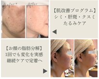 エルブラン(Herb ame)