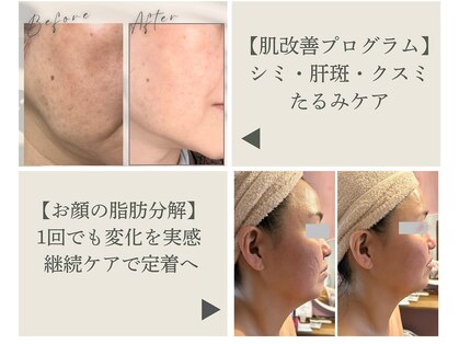 エルブラン(Herb ame)の写真