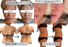 ティパニボーテ(Tipani Beaute')