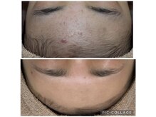 エステティック レイビス 川崎店(RAYVIS)/