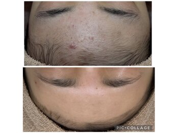 エステティック レイビス 川崎店(RAYVIS)/