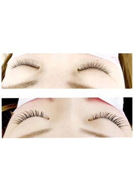 レセ(L’ce)/【ビフォーアフター】140本　　