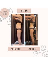 ビープロデュース 尾張旭店(B' PRODUCE)/20代　90分メニュー　24回