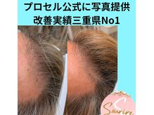 スリール(sourire)の雰囲気（三重県プロセル施術数No1/圧倒的な症例数☆プロセル業界最安）