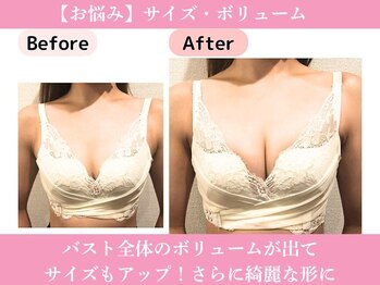 ピーグランディ 栄店(p-Grandi)/【お悩み】サイズ・ボリューム！