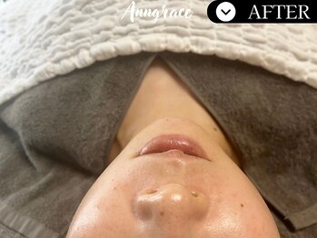 アングレイス(Anngrace)/【ポールシェリー】/After