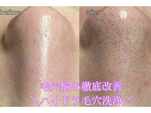 エミマス ボーテ(Emimas Beaute’)