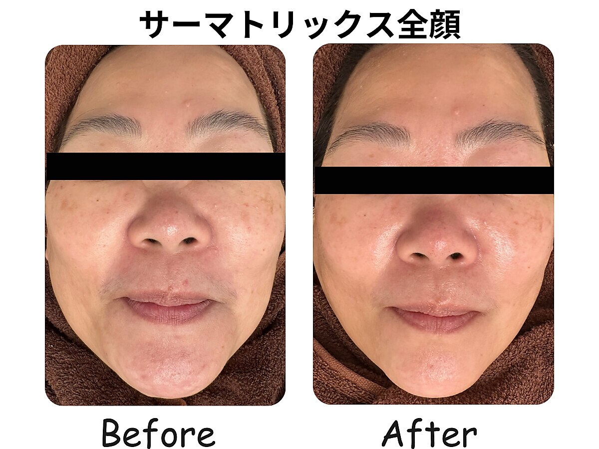 ラディアント たまプラーザ｜ホットペッパービューティー