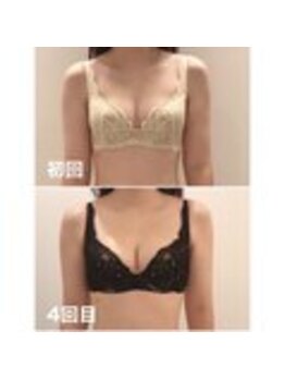 美人バスト 表参道店/【バストアップ/育乳 症例】