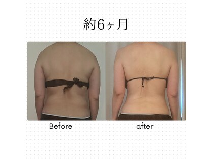 アカアカ('AKA'AKA)の写真