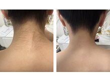 ミナミの雰囲気（キレイな首筋を♪】首を長く魅せ美しいアップヘア姿に ）