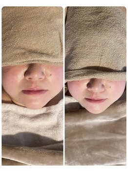 いちごいちえ/ビフォーアフター