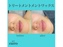 アクト クロ(ACT curro)/【フェイシャル】施術例