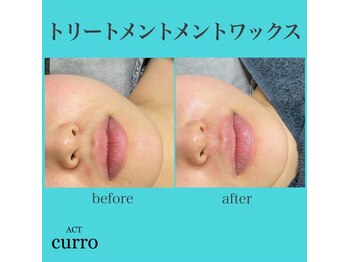 アクト クロ(ACT curro)/【フェイシャル】施術例