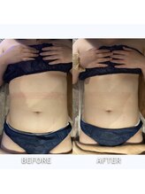 アランシア(Arancia)/