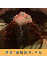 いつつのき/頭皮鍼