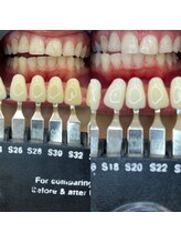 トウキョウスワーズ 池袋店(TOKYO SWRS)/#ホワイトニング #池袋 #渋谷