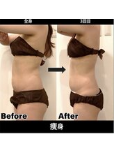 Sスタイルスタジオ 福岡天神/全身そう身3回目のお客様