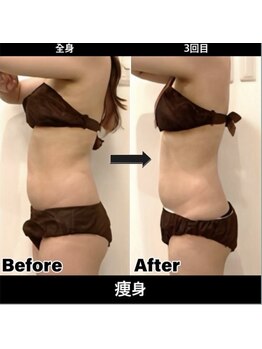 Sスタイルスタジオ 福岡天神/全身そう身3回目のお客様