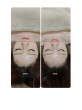 吉川美南ライフ整骨院/30代女性